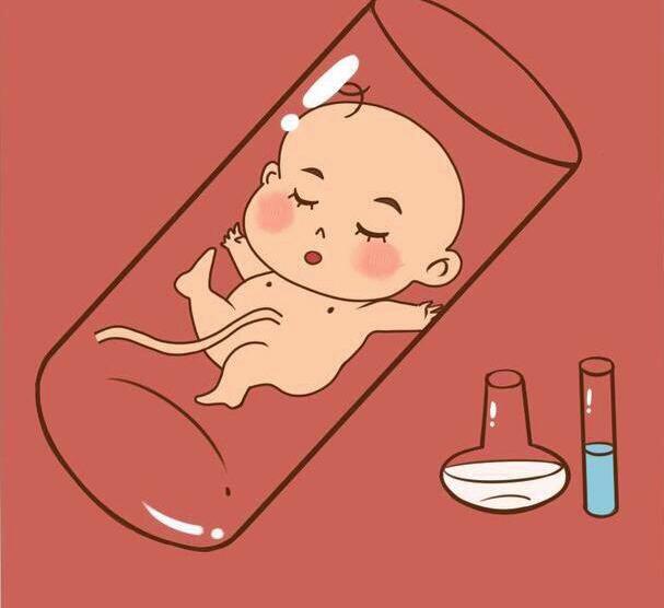 四维彩超