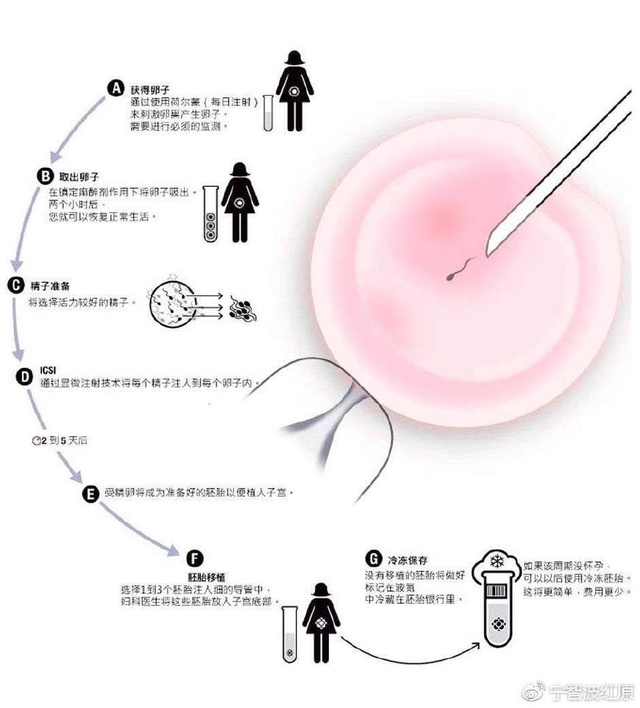 国外代孕