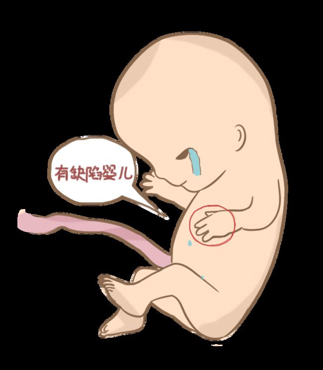 代孕