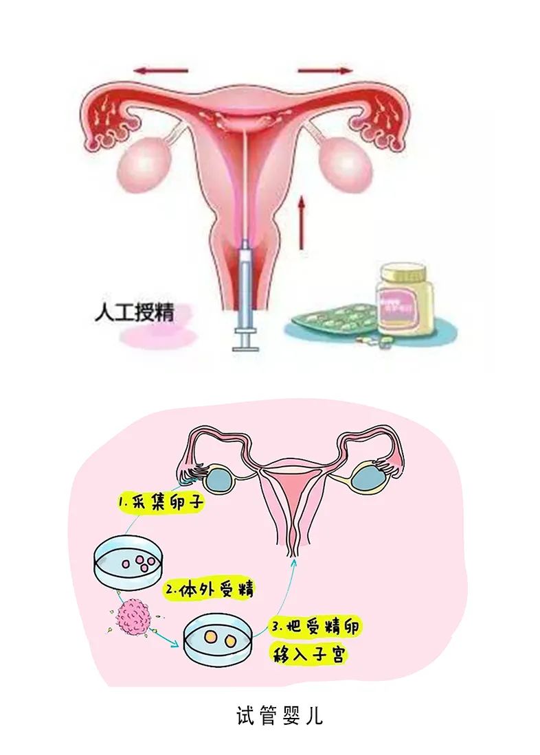 四川代孕公司