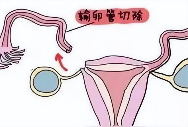 代孕选性别