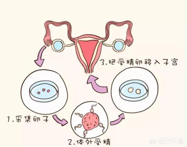 四川成都试管助孕费用